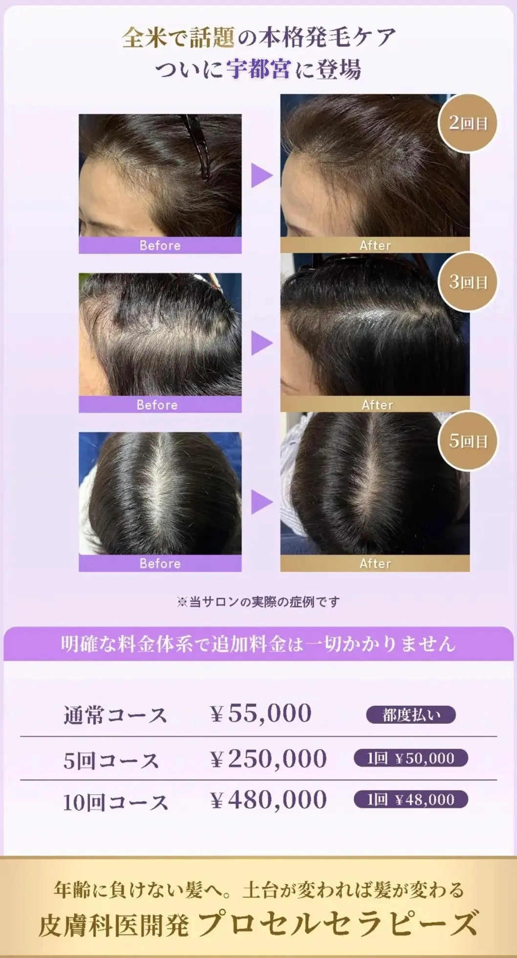 頭皮改善専門店が宇都宮市に上陸