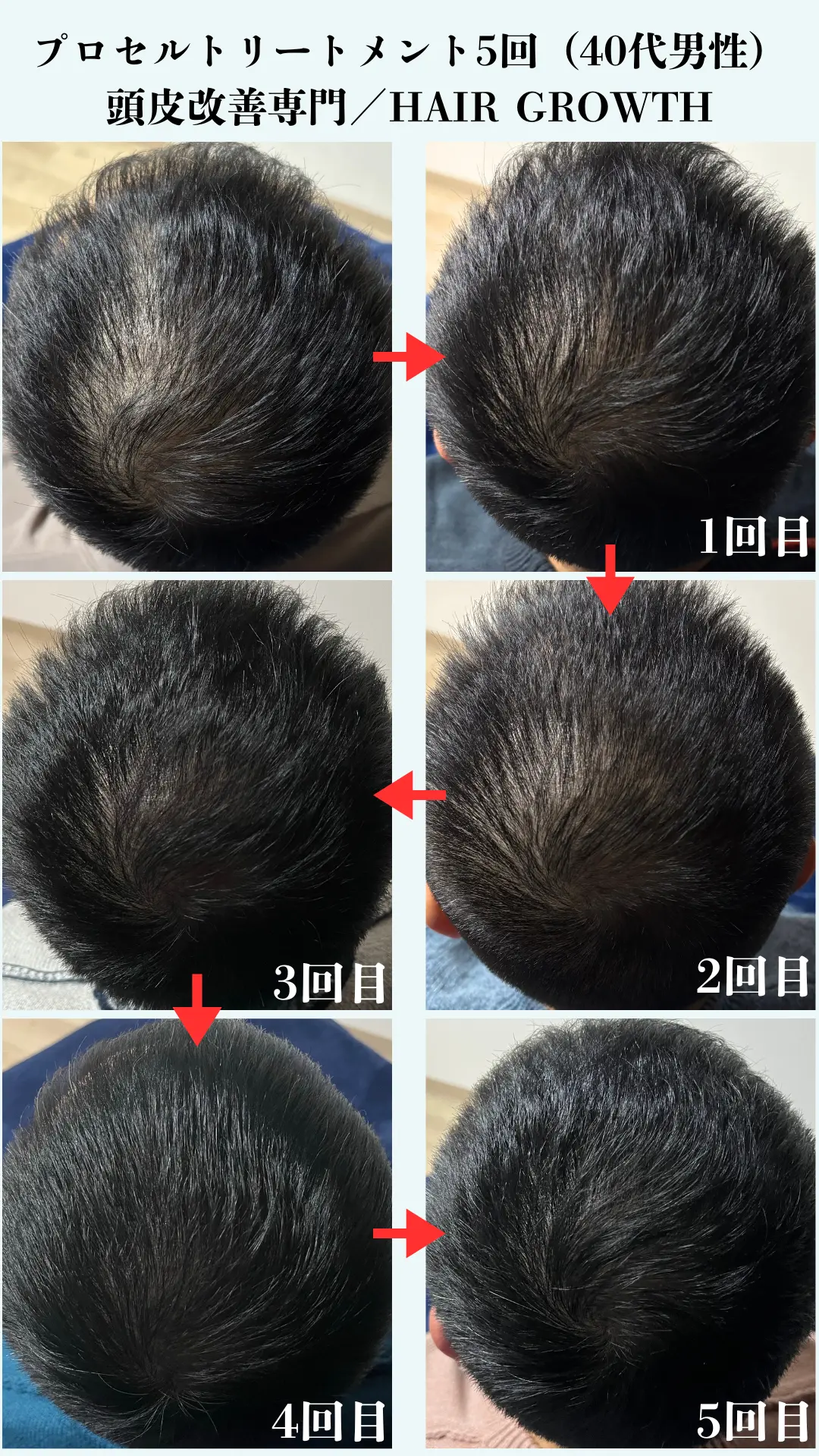 HAIR GROWTH ビフォーアフター